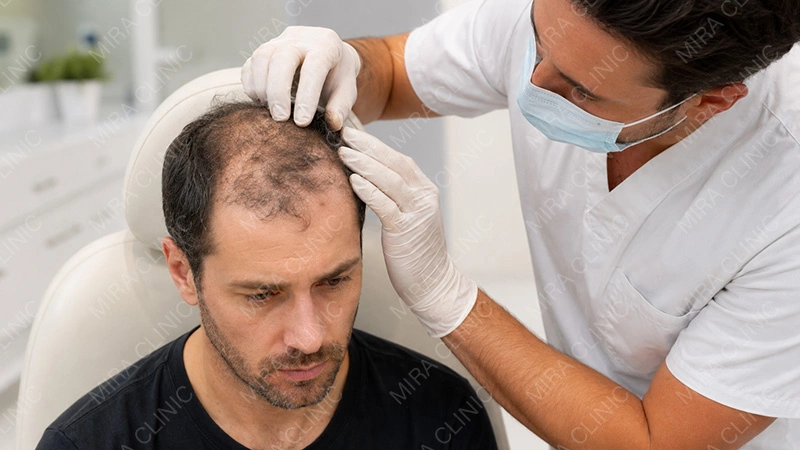hair transplant failed growth